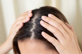 Jak pielęgnować przetłuszczające się włosy?